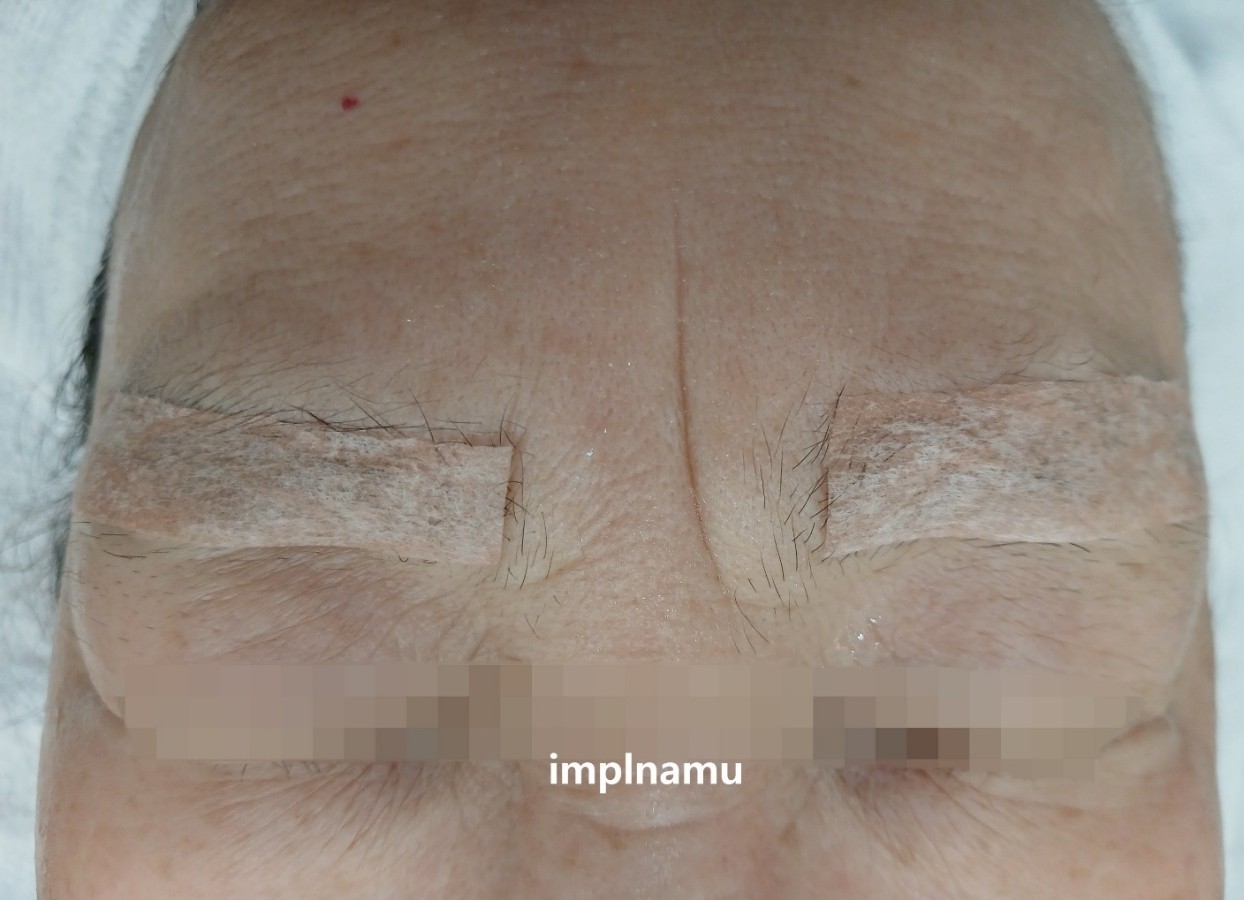 Before Image