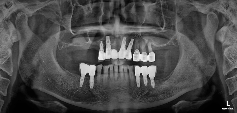 Before Image