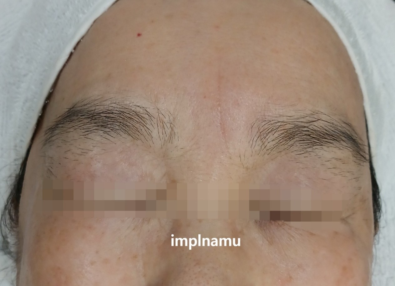 Before Image