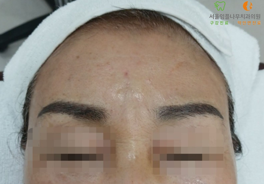 Before Image