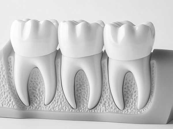 충치치료 자연치아살리기