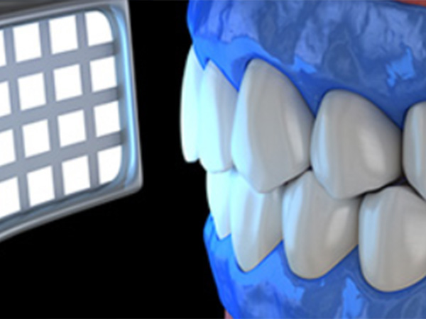 치아미백 심미치료